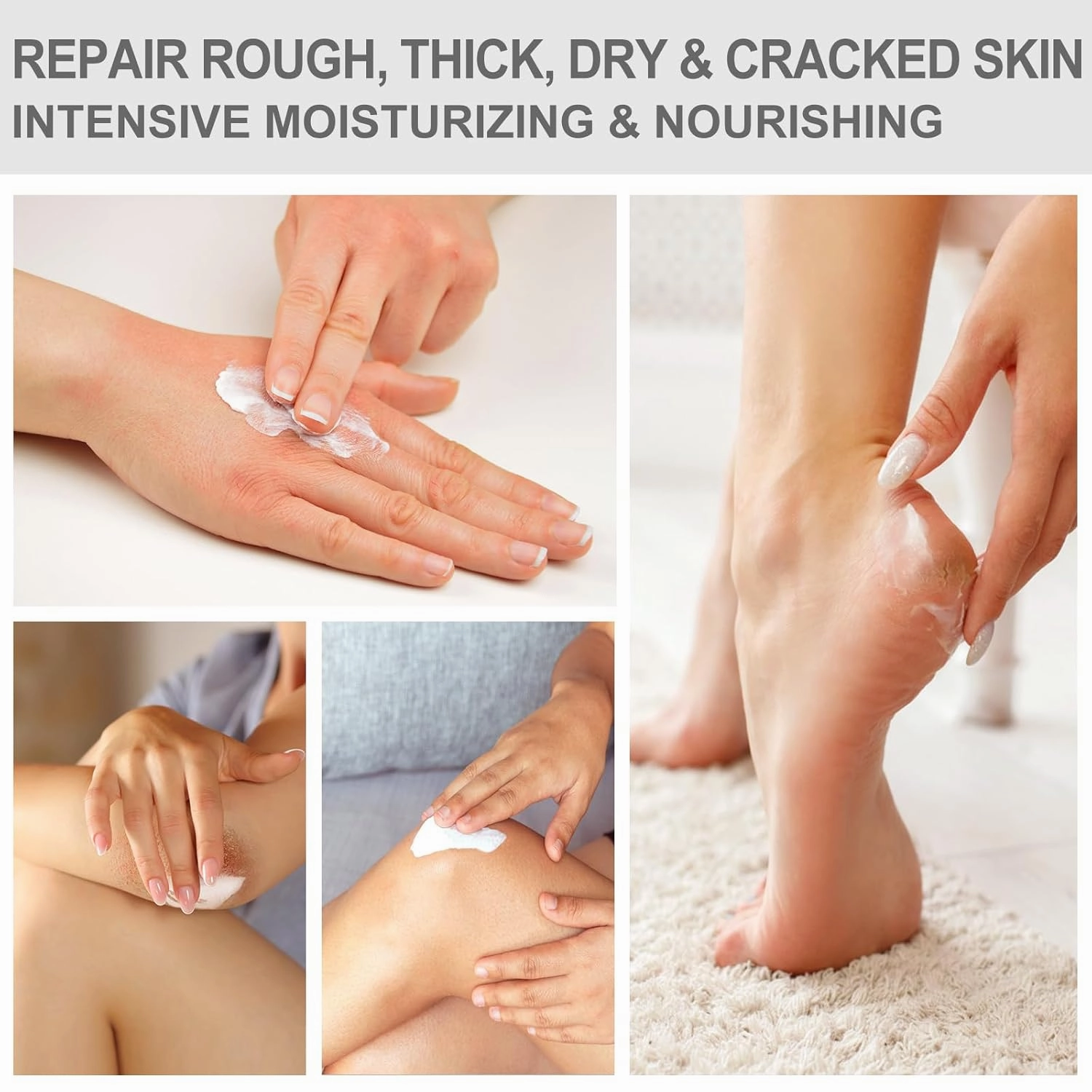 2 Packs Urea Cream 40 Percent - Foot & Hand Cream, for Dry, Cracked Heels, Feet, Knees, Elbows, and Hands, Callus Remover, Maximum Strength Urea Lotion for Softening and Moisturizing