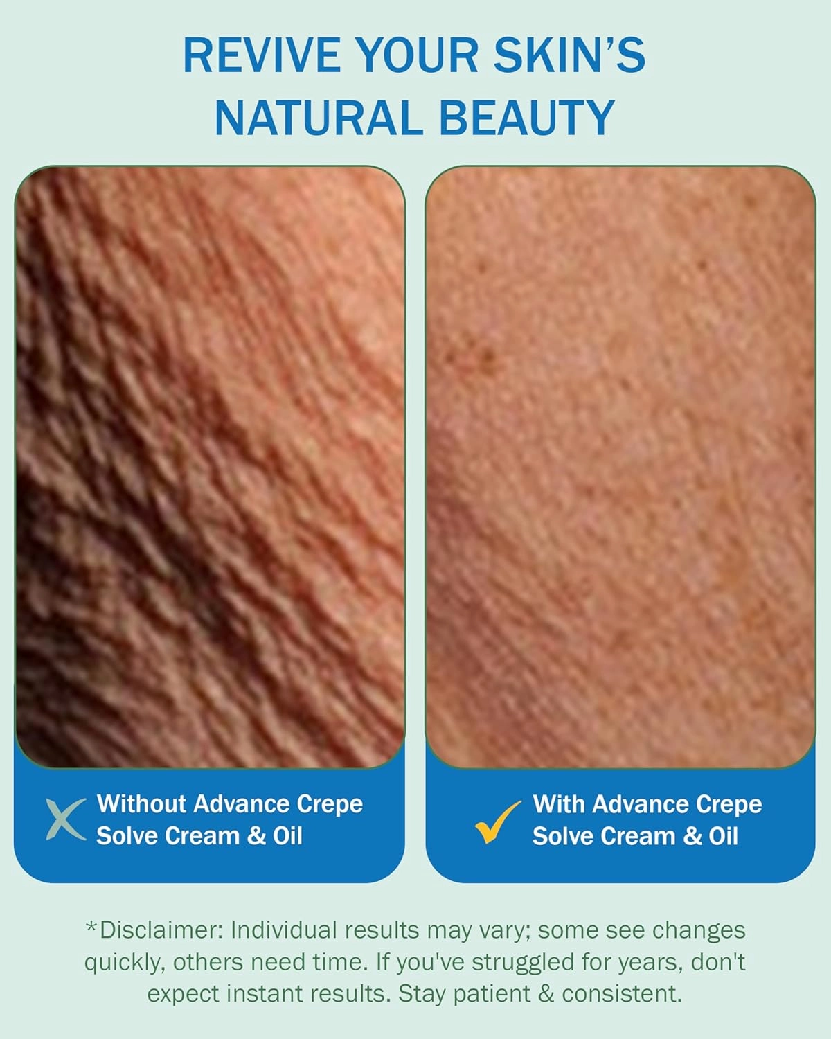 Advance Crepe Solve Hydrating Skin Oil for Women & Men - Made with Natural Oils, Licorice Root & Chamomile Extract - Moisturizing Body Oil for Skin Firmness & Elasticity, 2-Pack
