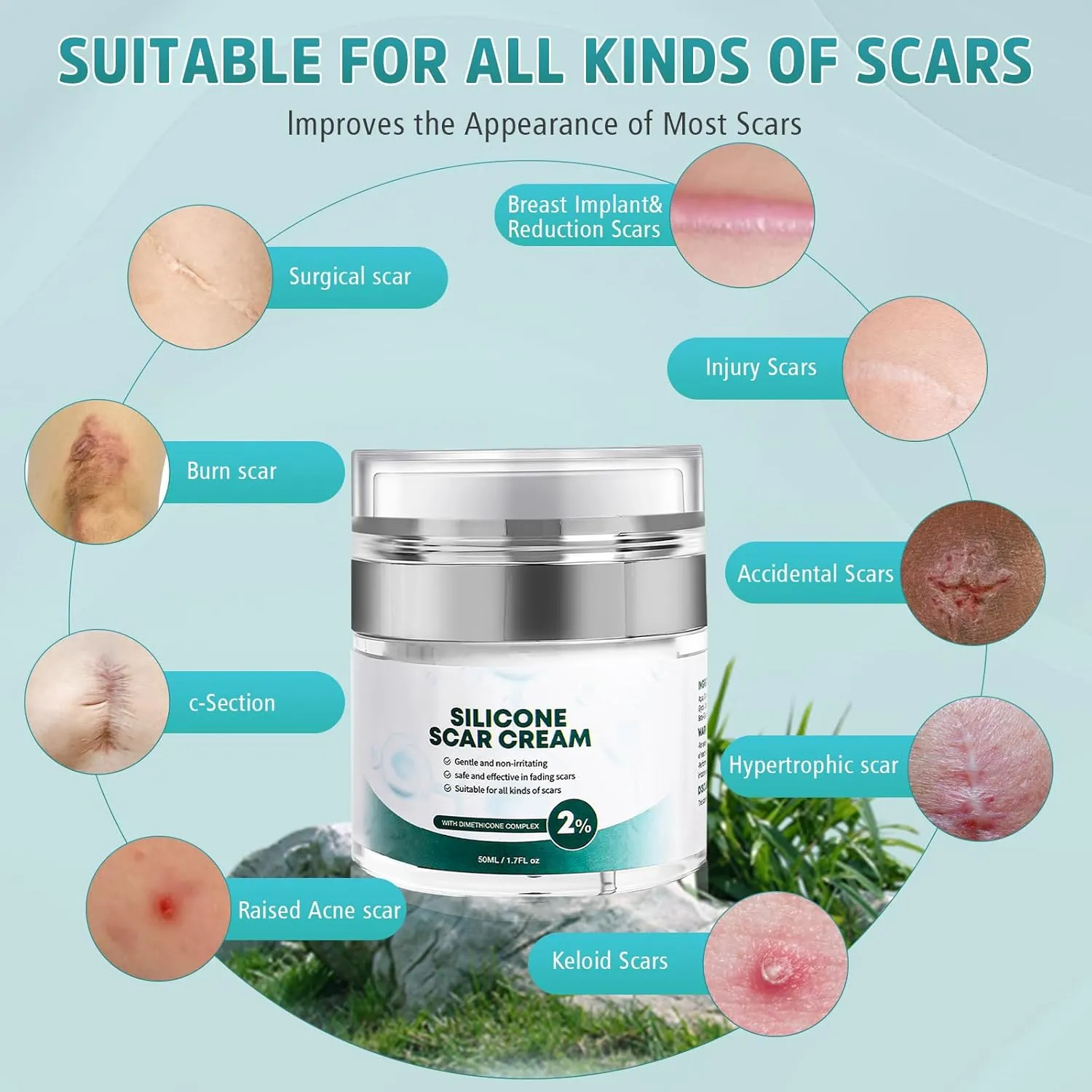 Advanced Scar Cream, Silicone Gel for Scars, Professional Scar Removal Cream for Surgical Scars, Stretch Marks, Old and New Scars 1.7 oz(50ml)
