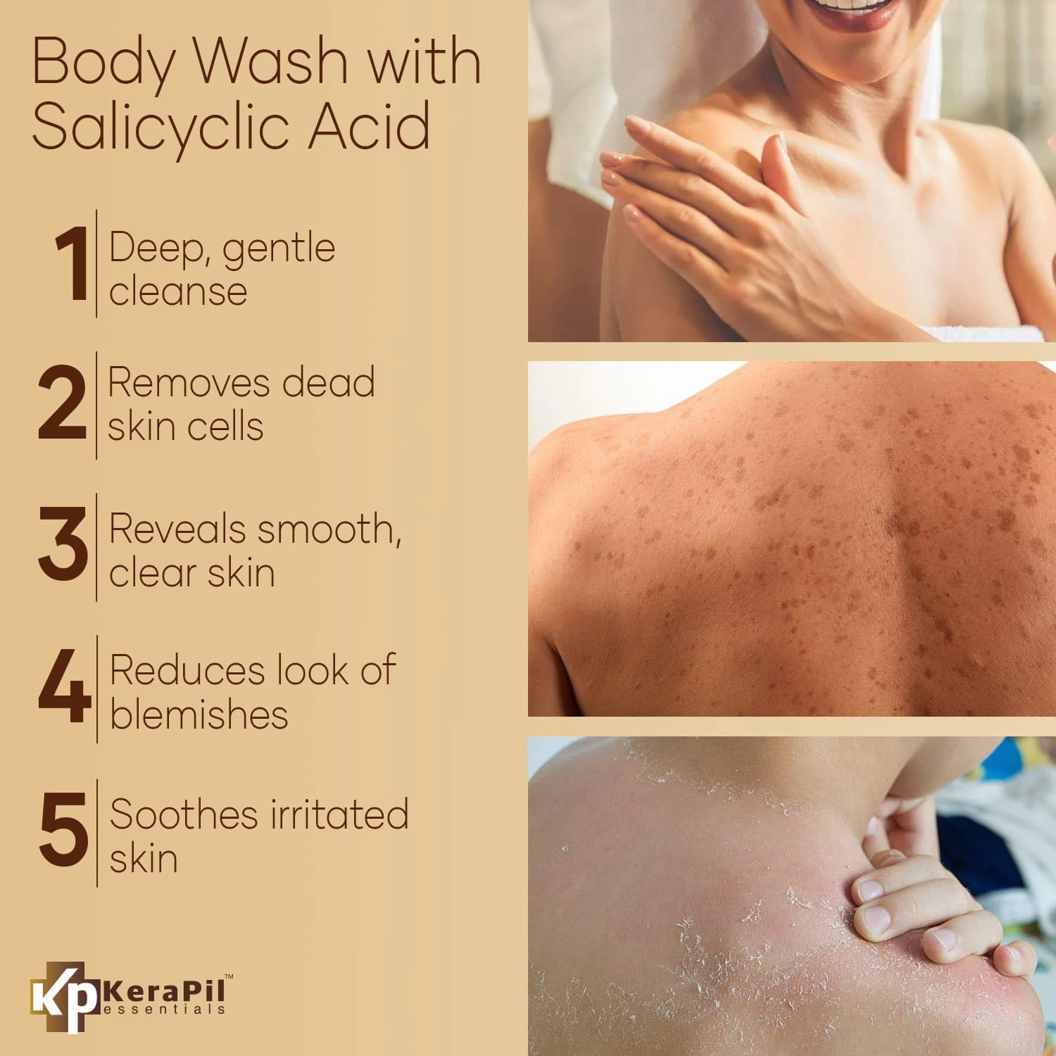 Exfoliating Body Wash with Salicylic Acid - No Dry Out, Gentle Exfoliates Rough and Bumpy Skin, Body Acne Wash, BHA & AHA - Coconut and Vanilla with Salicylic Acid - (16 fl oz)