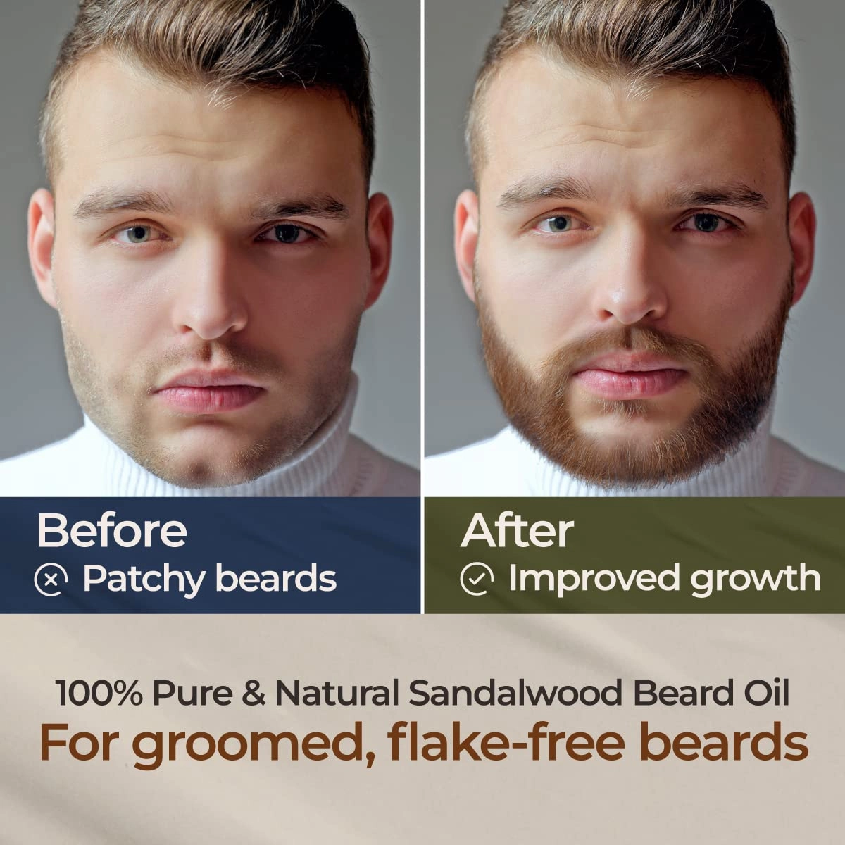 Gya Labs Sandalwood Beard Oil for Men Growth - 100% Pure Natural Beard Growth Oil for Men with Organic Argan & Jojoba - Moisturizes, Softens & Strengthens (1 Fl Oz x 3)