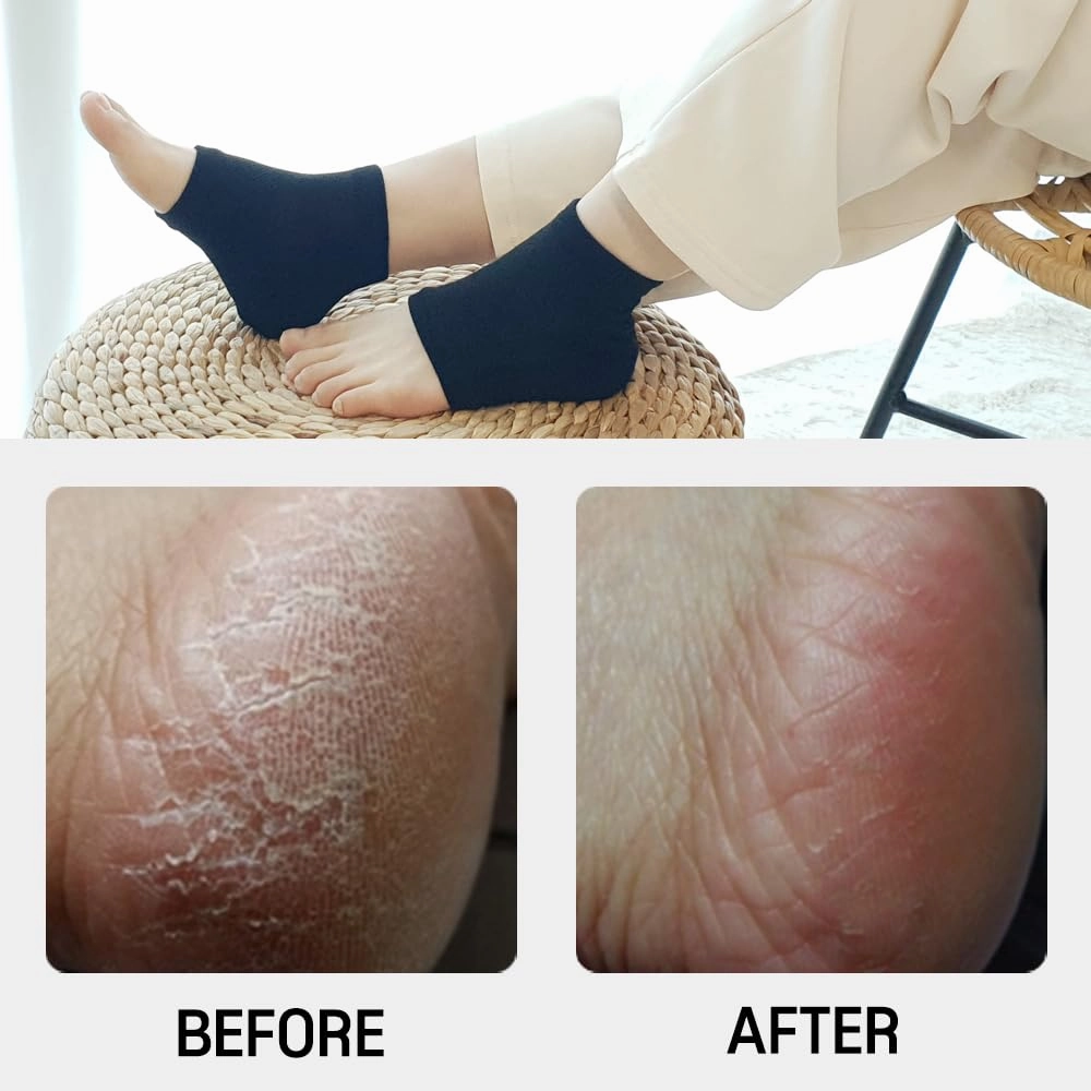 Moisturizing Gel Heel Socks to Repair Dry, Cracked Heels – Soften, Soothe & Revitalize Feet for Men & Women (Beige, 2 Pairs)