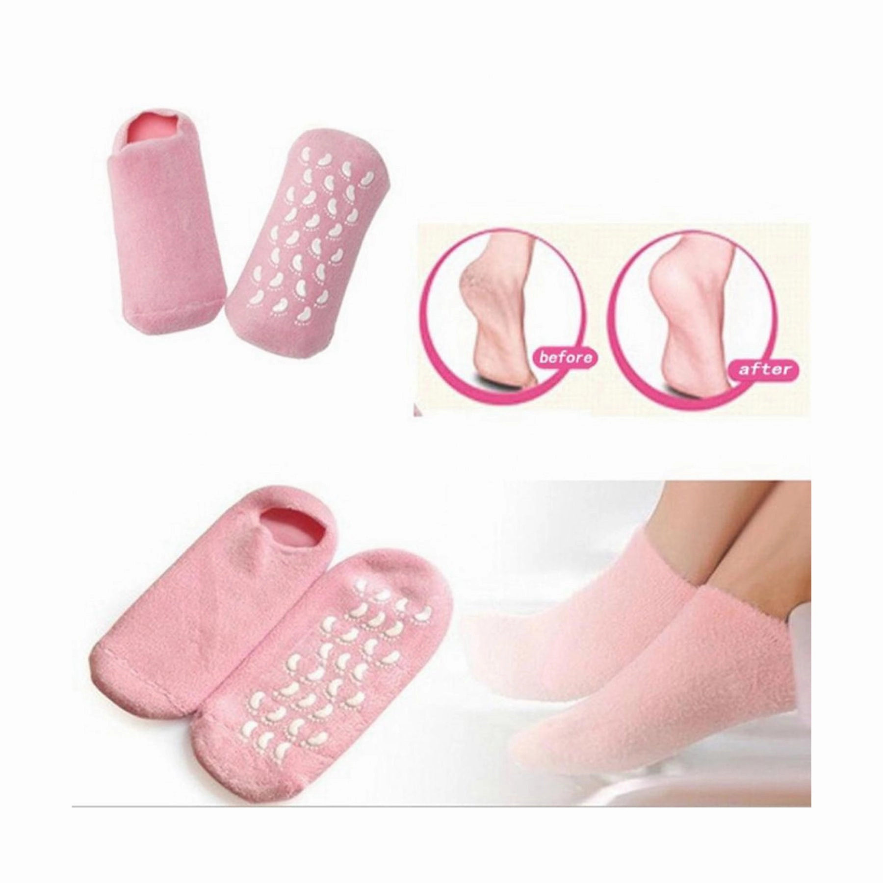 Spa Gel Socks for Cracked Feet