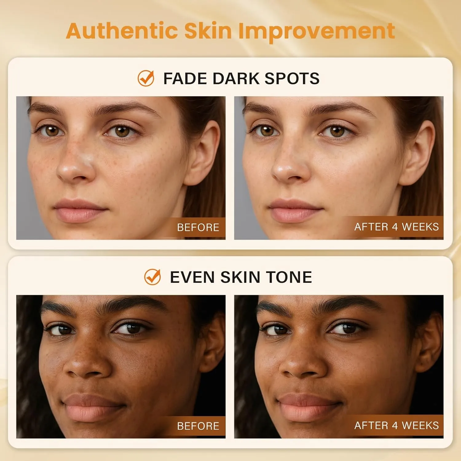 Turmeric Kojic Acid Soap Dark Spot Remover for face and body with Vitamin C, Retinol, Collagen, Original Japanese Complex - Vitamin E, Shea Butter, Castile Olive Oil (120g x 4Bars)
