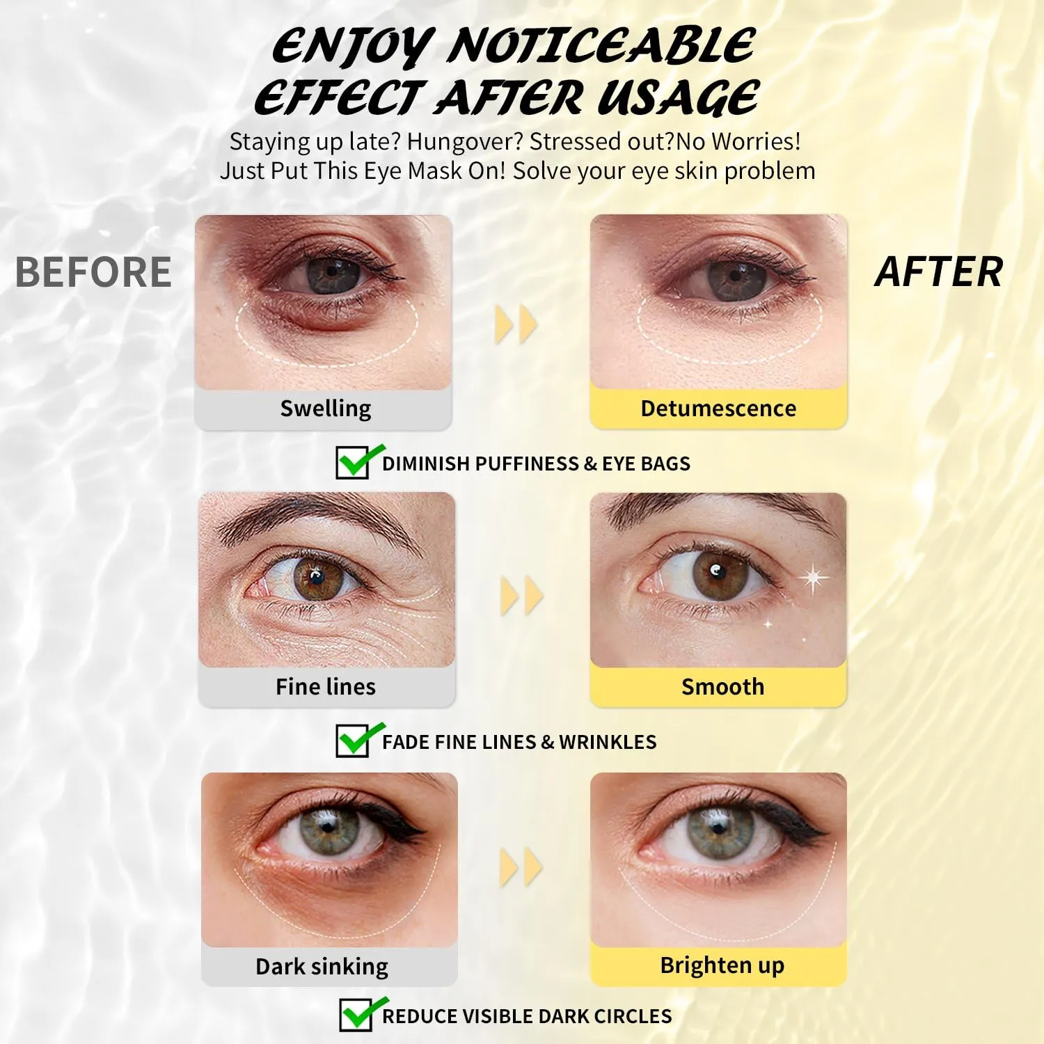 Under Eye Patches (25 Pairs), Hyaluronic Acid Eye Masks for Dark Circles Puffy Eyes Undereye Bags, Collagen Eye Patches for Wrinkles and Hydrate, Skin Care Gift for Her