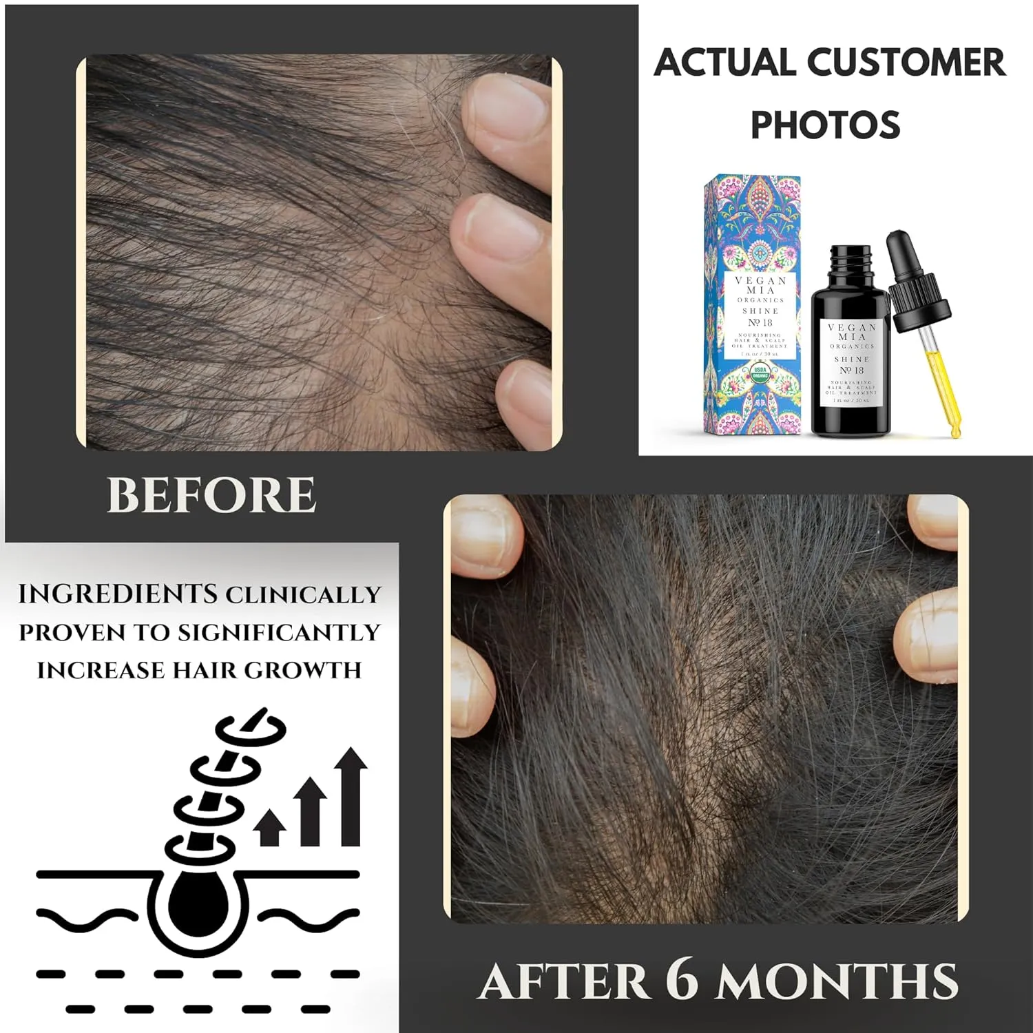USDA Organic Rosemary Oil for Hair Growth with Castor, Jojoba, Argan, Amla & More by Vegan Mia | Deeply Hydrates & Intense Nourishment for Itchy Scalp, Stubborn Dandruff & Dry Scalp Treatment, 4 Pack