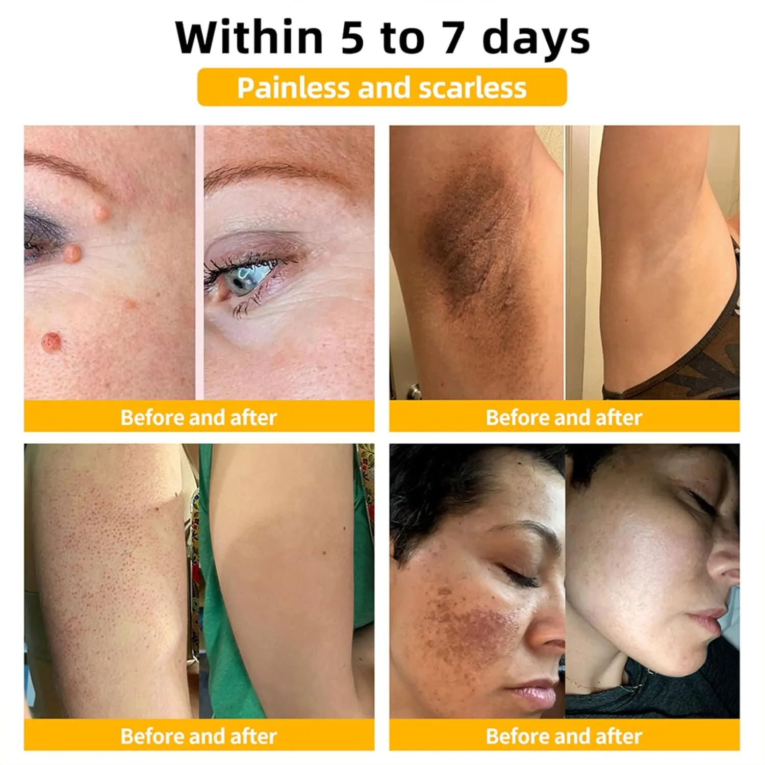 VLSVLS Anti-Aging Firming Lift Cream, Advanced Skin Firming Cream, VLSVLS Anti-Aging Cream, Restore Skin Elasticity for All Skin Types (4 Bottle)