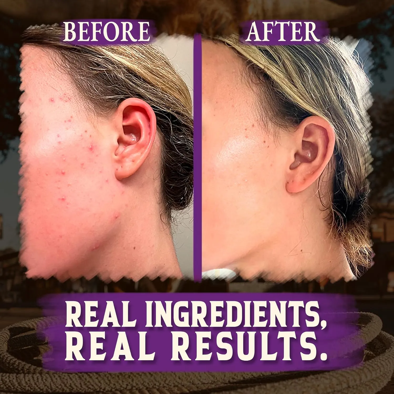 Wrath & Remedy Handmade Whipped Organic Beef Tallow for Skin - 4 OZ (Lavender) — Grass Fed Beef Tallow Moisturizer and Honey Balm for Silky, Sensitive-Skin, Eczema, Rosacea - Free of Harsh Chemicals